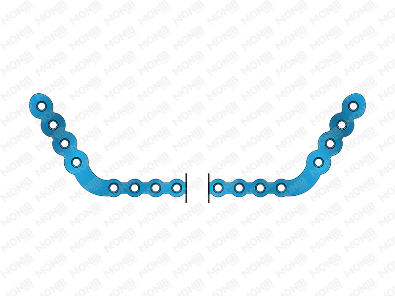 Full Mandibular Reconstruction Plate System