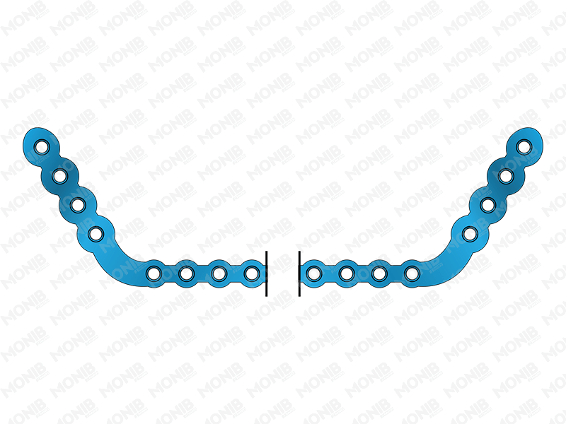 Mandibular Angle Plate System